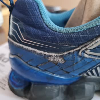 Skechers Çocuk Ayakkabısı Üretim Hatasının Marka Tarafından İnkarı