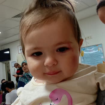 Isabel Abbey Globber Bisiklet Hatalı Üretim Yüzünden Bebeğim Düştü