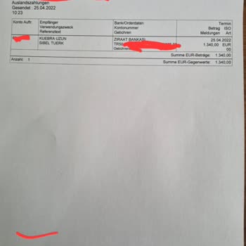 Dilan Polat Estetik Meme Dikleştirme + Protez Ve Göz Kapağı Estetik Mağduru!