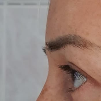 Dilan Polat Estetik Meme Dikleştirme + Protez Ve Göz Kapağı Estetik Mağduru!