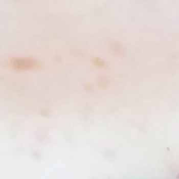 Orijinalliği Şüpheli Ürün La Roche Güneş Kremi Cosmolog