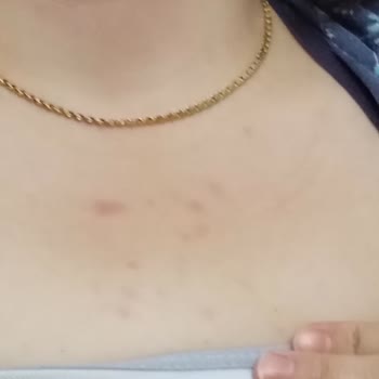 Orijinalliği Şüpheli Ürün La Roche Güneş Kremi Cosmolog