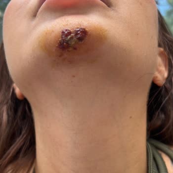 Sena Medikal Estetik Benim Yüzümü Mahvetti