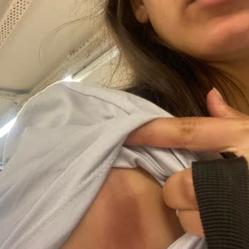 Aysira Gelinlik Sağlık Problemi Darbe Aldım Üründen