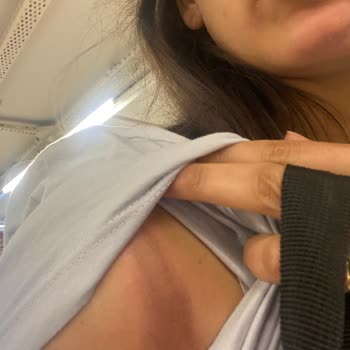 Aysira Gelinlik Sağlık Problemi Darbe Aldım Üründen