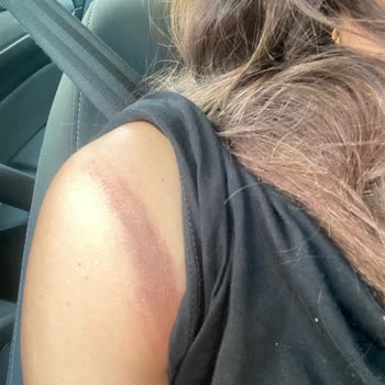 Aysira Gelinlik Sağlık Problemi Darbe Aldım Üründen