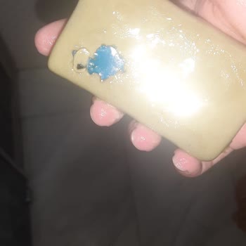 Duru Sabun Yabancı Cisim Çıkması