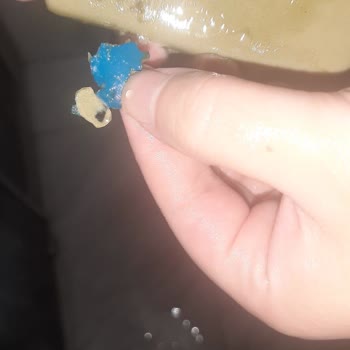 Duru Sabun Yabancı Cisim Çıkması