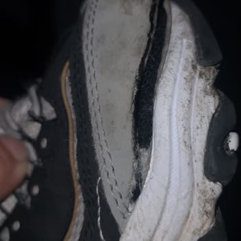 5 Ayda Paramparça Olan 2000 TL'lik Skechers Çocuk Ayakkabısı