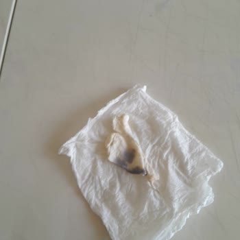 Dost Yoğurttan Çıkan Plastik Parça