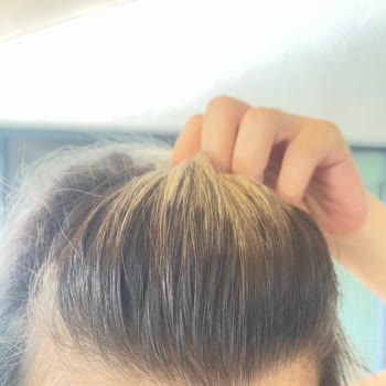 Coşkun Kurban Hair Center Yapılan İşlemi Beğenmediğimizi Söyleyince Hakarete Uğradık.