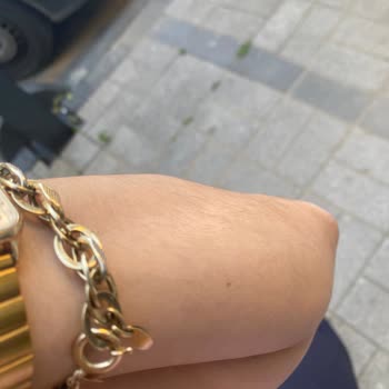 Neslim Güngen Silivri Şubesindeki Lazer Hizmetinden Memnun Kalmadım