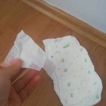Baby Turco Bez Cırtları Yırtılıyor