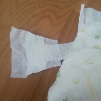 Baby Turco Bez Cırtları Yırtılıyor
