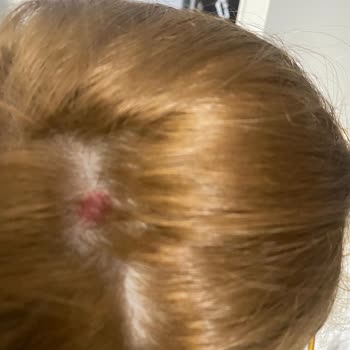 Palette 10.1 Derim Delindi