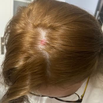 Palette 10.1 Derim Delindi