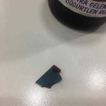 Tat Gıda Tat Şeker İlavesiz Böğürtlen Reçeli İçinden Plastik Parça Çıkması
