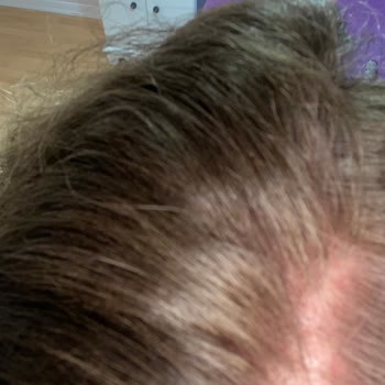 Loreal Paris Beyaz Saçlarım Kapanmaması