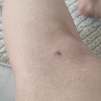 Suit Güzellik Merkezi Denizli Şikayet