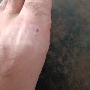 Adidas Hatalı Ürün Olmasına Rağmen Olumsuz Yanıt.