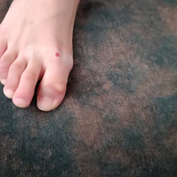 Adidas Hatalı Ürün Olmasına Rağmen Olumsuz Yanıt.