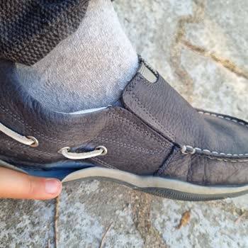 Scooter Ayakkabım 2. Ayında Parçalandı