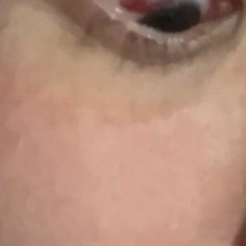 Medica Derma Yaptıkları İşlem Yüzünden Sağlığımdan Oldum!