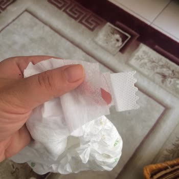 Baby Turco Cırtları Yırtık Çıktı