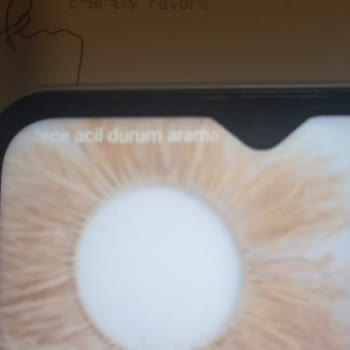 Samsung Telefon Ve Media Markt İş Bilmezliği