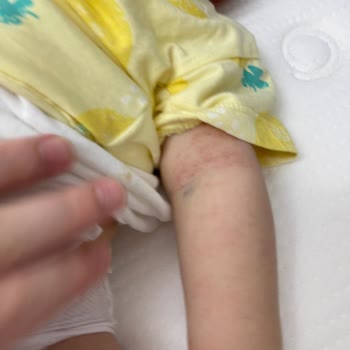 Medicana Hospitals Hastane Sorumsuzluğu Ve İlgisizliği