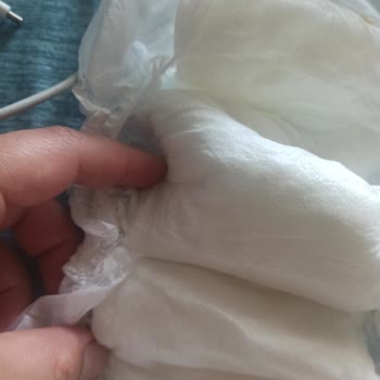 Baby Turco Bebek Bezinin Sızdırması Ve Anlam Veremediğim Yapışkanlık