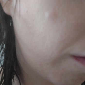 Neutrogena Krem Yüze Verdiği Zarar