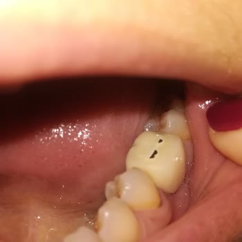 Antalya Ağız Ve Diş Sağlığı Hastanesi