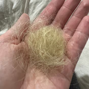 Dilan Polat Estetik Hair Nail Mikro Kaynak İşlemi