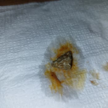 Tarım Kredi Kooperatif Market Barbunyanın İçinde Taş Çıkması