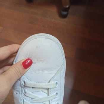 SuperStep Mağazasından Aldığım Adidas Ayakkabı Deformasyonu