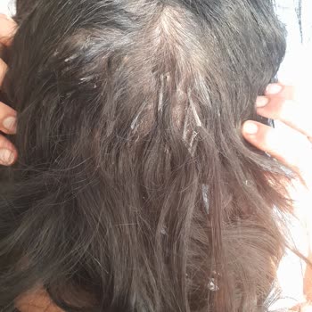 Kuaför Osman Kaynak Saçlarımı Mahvettiler