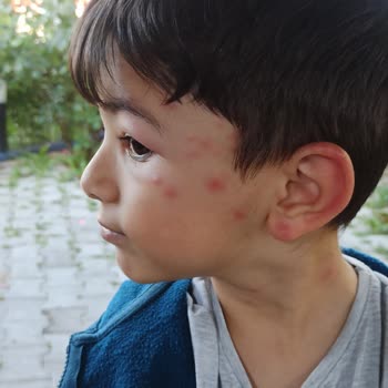 Perre Art Hotel Çilesi