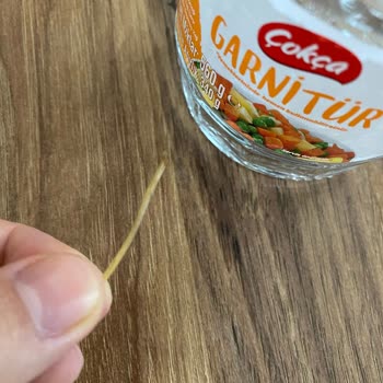 A101 Den Aldığım Çokça Garnitürden Yabancı Madde Çıktı