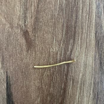 A101 Den Aldığım Çokça Garnitürden Yabancı Madde Çıktı