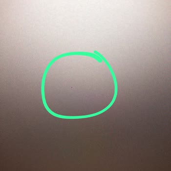 Migros Xiaomi Marka Monitör Ölü Piksel Sorunu