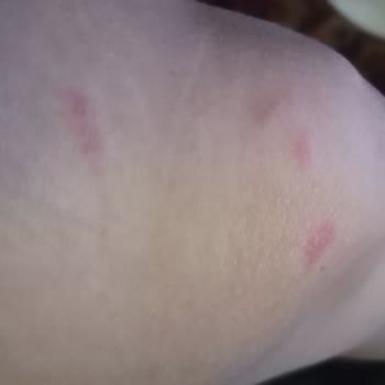 Pırlanta Güzellik Pırlanta Estetik Ve Güzellik K. Çekmece / İstanbul