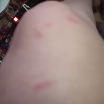 Pırlanta Güzellik Pırlanta Estetik Ve Güzellik K. Çekmece / İstanbul