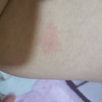 Pırlanta Güzellik Pırlanta Estetik Ve Güzellik K. Çekmece / İstanbul