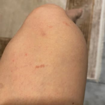 Pırlanta Güzellik Pırlanta Estetik Ve Güzellik K. Çekmece / İstanbul