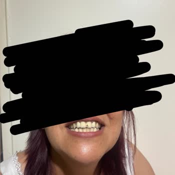 Özel Elvankent Ağız Ve Diş Sağlığı Polikliniği Garanti Sorunu