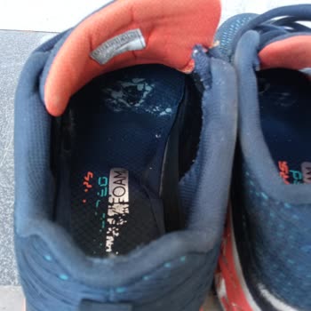 Skechers Kötü Ayakkabıları 3 Ayda Bozuldu