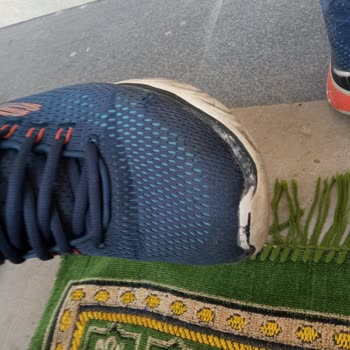 Skechers Kötü Ayakkabıları 3 Ayda Bozuldu