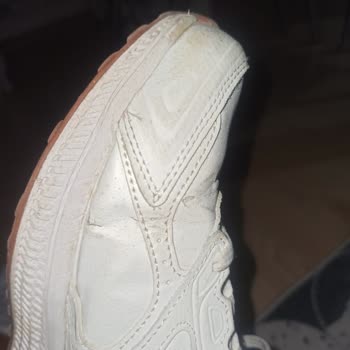 3 Ayda Skechers Ayakkabı Kullanılamaz Hale Geldi