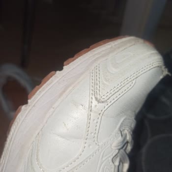 3 Ayda Skechers Ayakkabı Kullanılamaz Hale Geldi